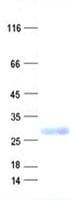 Human SLC25A48 Protein (Recombinant His, N-Terminal)