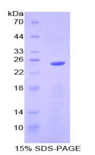 Mouse SPRY2 / Sprouty 2 Protein (Recombinant His-T7)