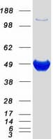 Human NADK / NAD Kinase Protein (Recombinant Myc-DDK (Flag))