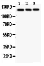 Polyclonal Rabbit anti-Human SLC12A1 / NKCC2 Antibody (aa52-83, IHC, WB)