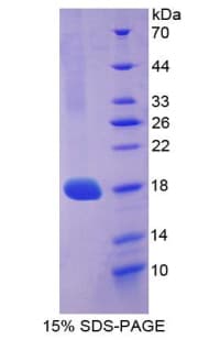 Bovine VEGFA / VEGF Protein (Recombinant His-T7)