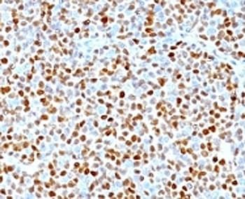 CCND1 / Cyclin D1 Antibody (clone SPM587, Azide-free, BSA-free)