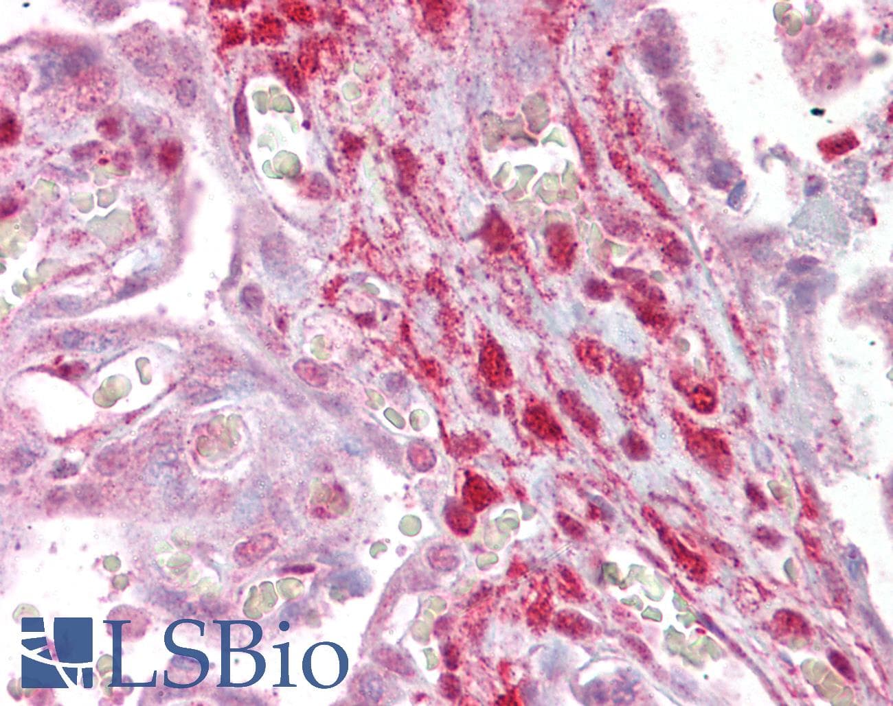 IHC-plus™ CNN2 Antibody (aa292-306)