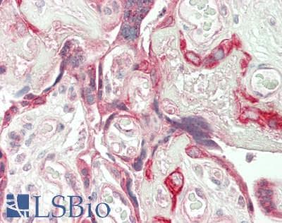 IHC-plus™ ID / ID1 Antibody (Internal)