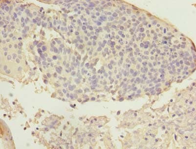 ARMC7 Antibody