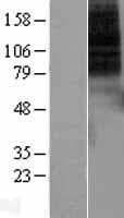 DRD1 / Dopamine Receptor D1 Protein (Over-Expression Lysate Myc-DDK (Flag))