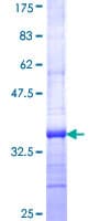 Human SLC27A5 / BACS Protein (Recombinant GST, N-terminus)