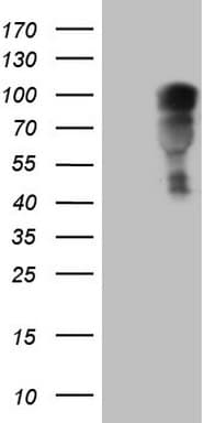 NR3C1/Glucocorticoid Receptor Antibody (aa1-265, clone OTI2C4)
