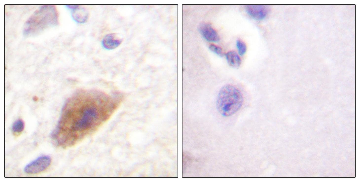 TH / Tyrosine Hydroxylase Antibody (p8)