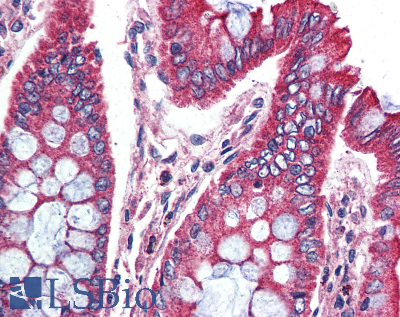 IHC-plus™ Polyclonal Rabbit anti-Human SPHK / SPHK1 Antibody (N-Terminus, IHC)