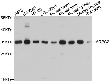 ARPC2 / p34-Arc Antibody