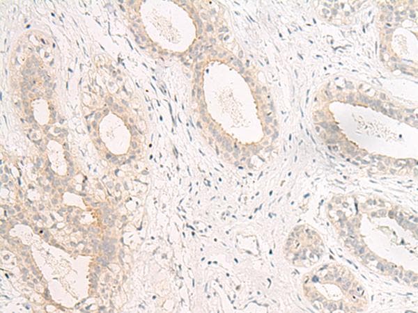 Polyclonal Rabbit anti-Human GPR157 Antibody (IHC)