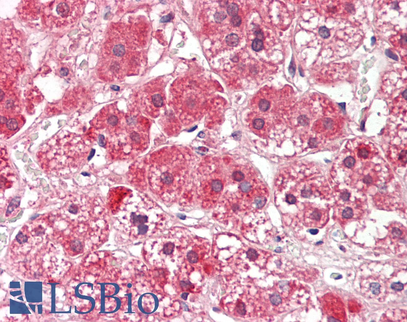 Polyclonal Rabbit anti-Human ALDH3A2 Antibody (aa179-228, IHC, WB)