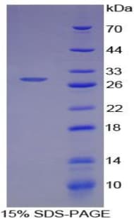 Human ATF4 Protein (Recombinant His-T7)