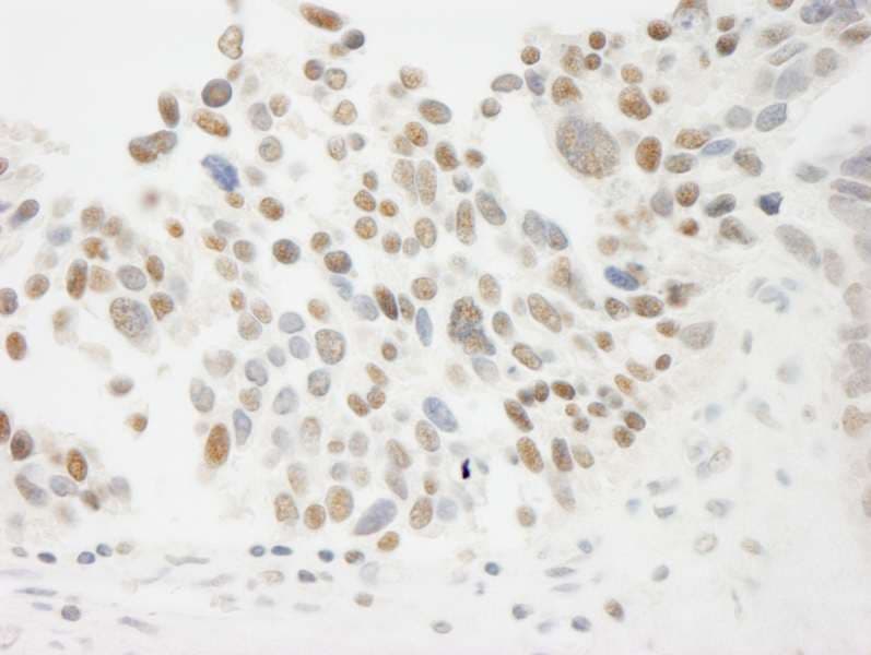 THOC5 Antibody (aa25-75)