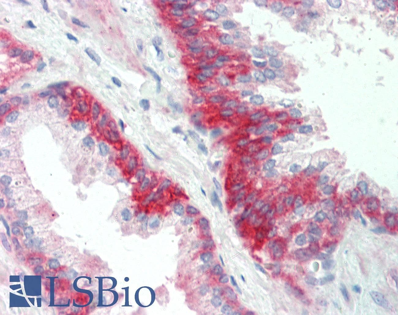 IHC-plus™ SGPP1 Antibody (aa13-42)