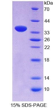 Human PCNT / Pericentrin Protein (Recombinant His-T7)