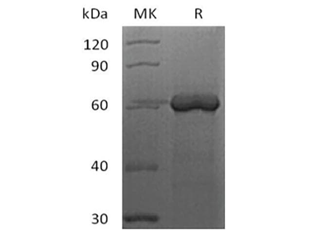 Human FGL1 / Hepassocin Protein (Recombinant Fc-AVI, C-terminus)