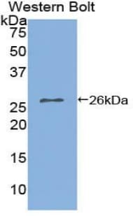 IL2RA / CD25 Antibody (aa22-213)