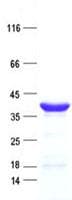 Human KCTD7 Protein (Recombinant His, N-Terminal)