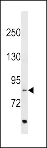 EVI5L Antibody (aa738-764)