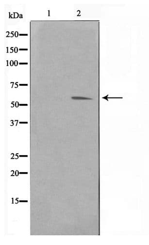 PIM1 / Pim-1 Antibody