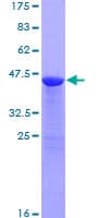 Human OMP Protein (Recombinant GST)