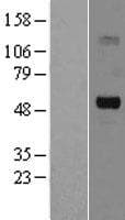SLC5A7 / Choline Transporter Protein (Over-Expression Lysate Myc-DDK (Flag))