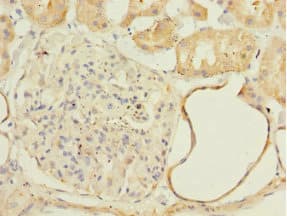 Polyclonal Rabbit anti-Human NDUFA13 / GRIM19 Antibody (IHC, WB)