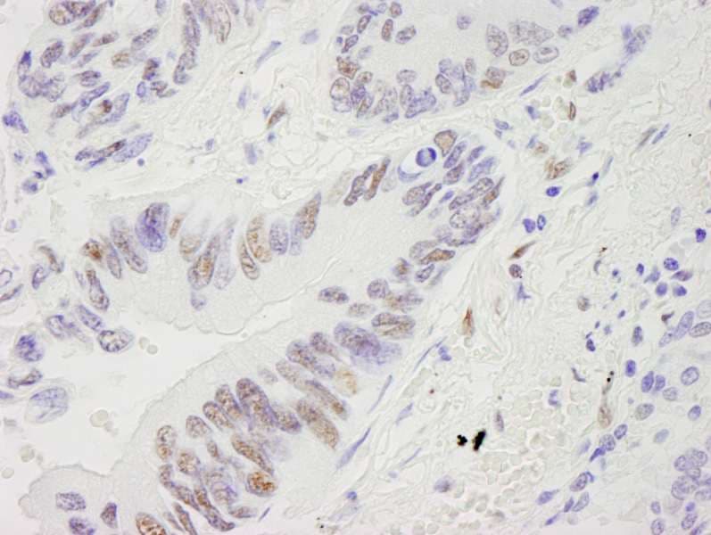 RECQ1 / RECQL Antibody (aa600-C-term)