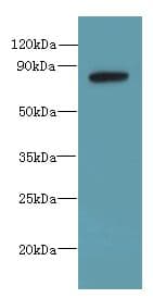 PBXIP1 / HPIP Antibody