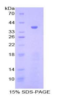 Human Gamma-Lipotropic Hormone Protein (Recombinant His-GST)
