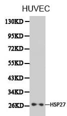 Polyclonal Rabbit anti-Human IKBKE / IKKI / IKKE Antibody (IHC, WB)