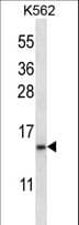 BAFF Receptor / CD268 Antibody (aa1-30)