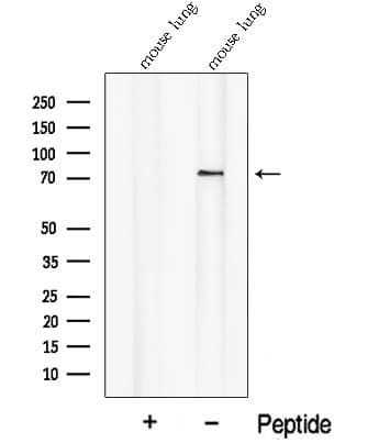 Polyclonal Rabbit anti-Human PALMD Antibody (WB)