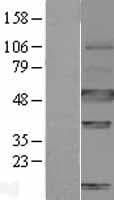 CA9 / Carbonic Anhydrase IX Protein (Over-Expression Lysate Myc-DDK (Flag))