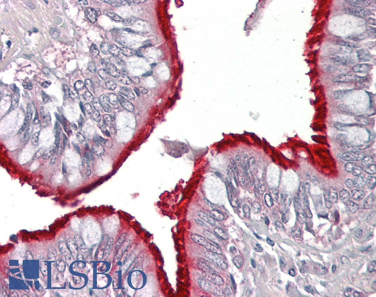 IHC-plus™ RAMP2 Antibody