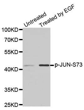 JUN / c-Jun Antibody (phospho-Ser73)