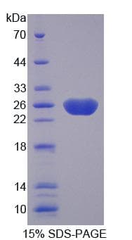 Human Fibulin-3 / EFEMP1 Protein (Recombinant His)