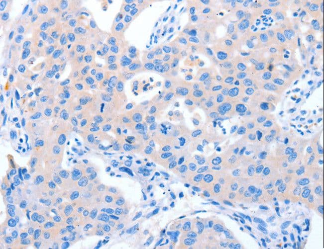 NUAK1 / ARK5 Antibody