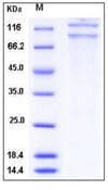 Human ITGAX + ITGB2 Heterodimer Protein (Recombinant DDK (Flag)-His, C-terminus)