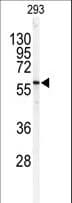 SPTLC1 / HSN1 Antibody (aa405-437)