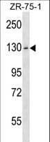 HKDC1 Antibody (aa825-853)