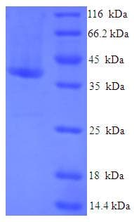 Human CRADD / RAIDD Protein (Recombinant His-SUMO)