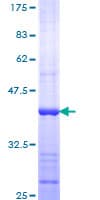 Human DICER1 / Dicer Protein (Recombinant GST, N-terminus)