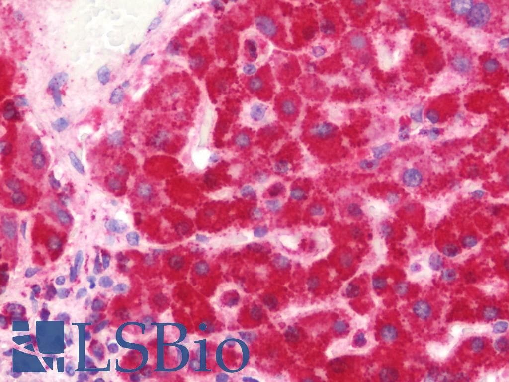 IHC-plus™ Polyclonal Rabbit anti-Human MDH / MDH2 Antibody (aa40-319, IHC, WB)