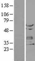 CHODL / Chondrolectin Protein (Over-Expression Lysate Myc-DDK (Flag))