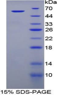 Human TGM1 / Transglutaminase Protein (Recombinant GST-6His, N-terminus)