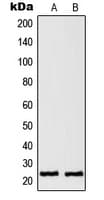 RAN Antibody (C-Terminus)