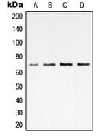 Polyclonal Rabbit anti-Human RELA / NFKB p65 Antibody (C-Terminus, WB)